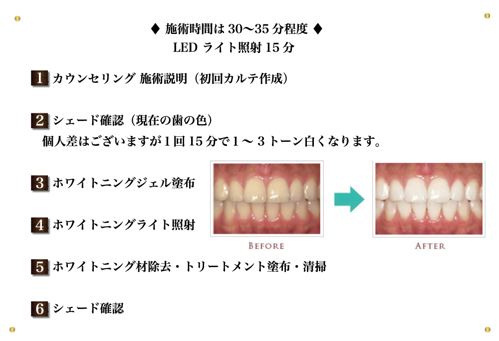 施術時間と照射時間